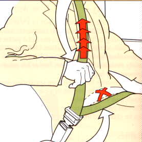 Lap belt low on hips